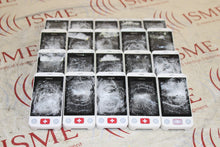 Load image into Gallery viewer, Lot of 20x Mindray Benevision TD60 Telemetry Transmitters