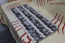 Load image into Gallery viewer, Mindray BeneVision TD60 Telemetry Transmitter -Parts/Repair