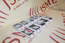 Load image into Gallery viewer, LOT OF 10!- Mindray BeneVision TM70 Telemetry Transmitter -Parts/Repair