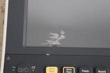 Load image into Gallery viewer, Mindray Passport 8 Replacement Screen (scratched) &amp; Front Bezel
